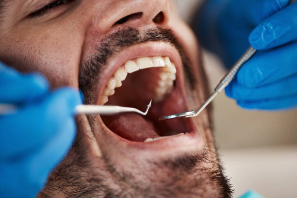 Best Emergency Treatment for Oral Infections in Winchester, NV