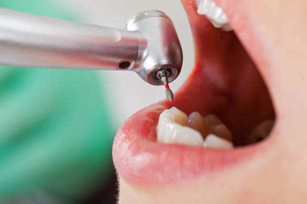 Best Lost Filling or Crown Replacement in Winchester, NV
